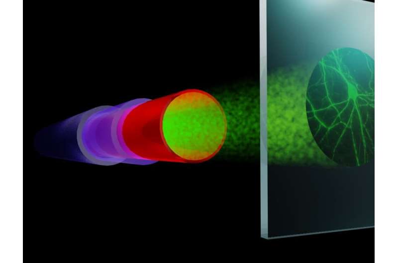 Fiber imaging beyond the limits of resolution and speed