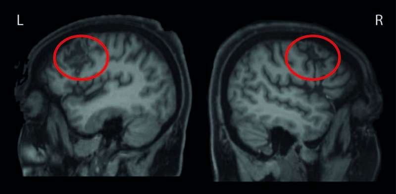 Found: Brain structure that controls our behavior