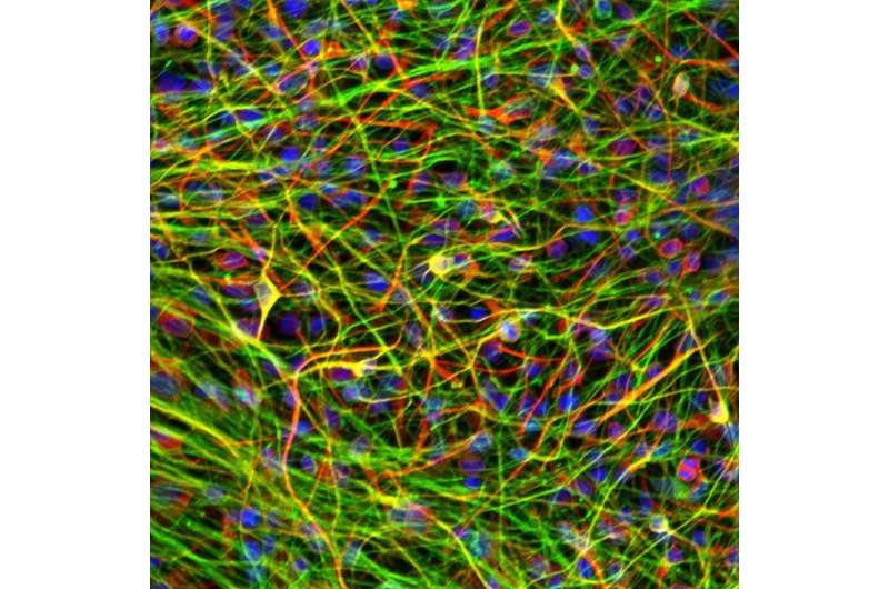 Gene pathway linked to schizophrenia identified through stem cell engineering