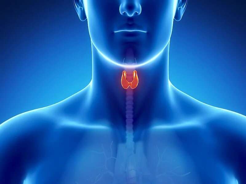 Global burden of thyroid cancer is increasing