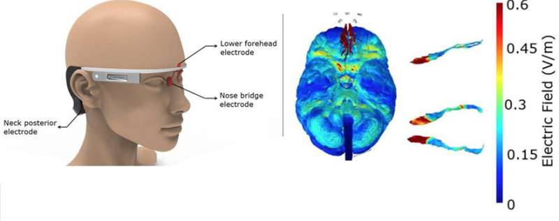 Google-glass-like electrical stimulator to zap Alzheimer's Disease