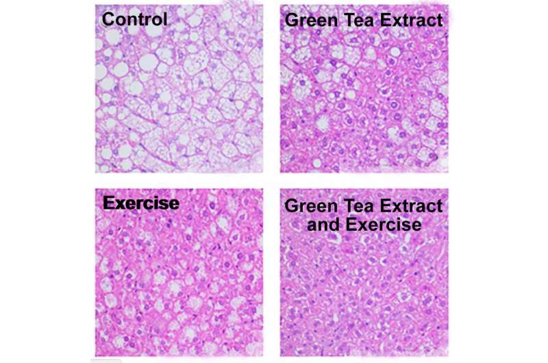 Green tea extract combined with exercise reduces fatty liver disease in mice