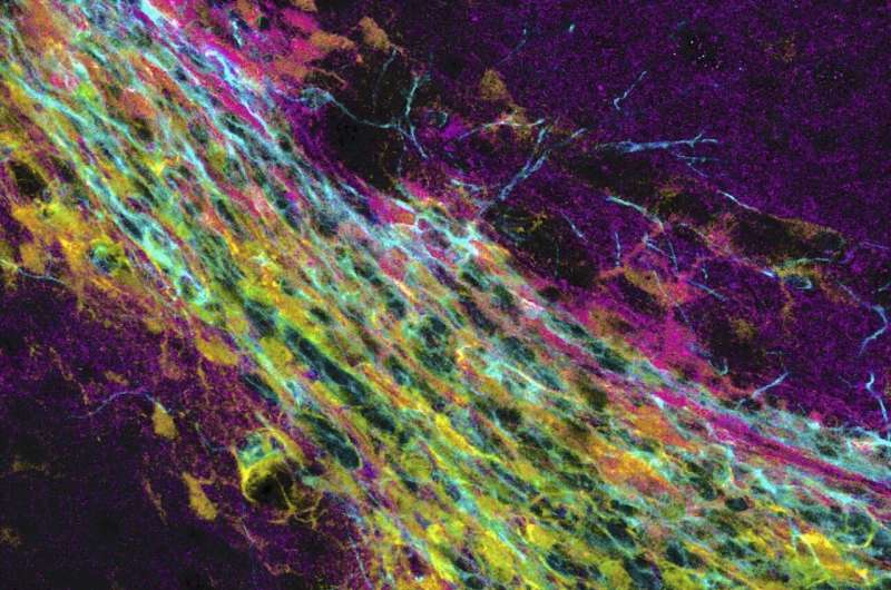 Hard times are coming: Brain tissue stiffness is crucial for neurogenesis