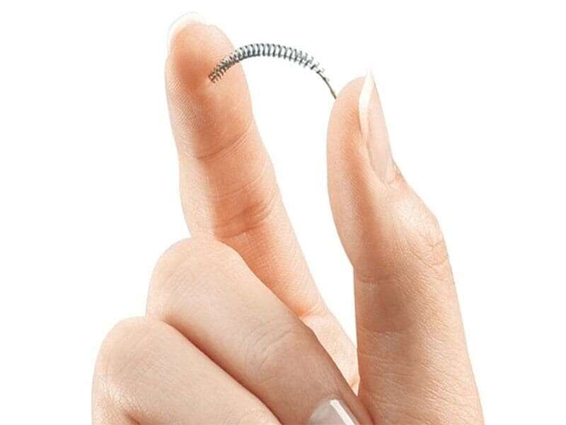 Higher rates of pain, bleeding found with essure birth control device