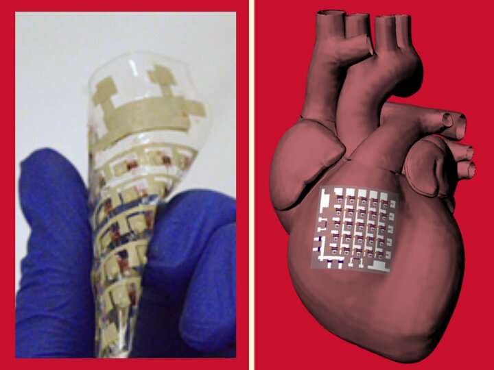 Implantable device can monitor and treat heart disease