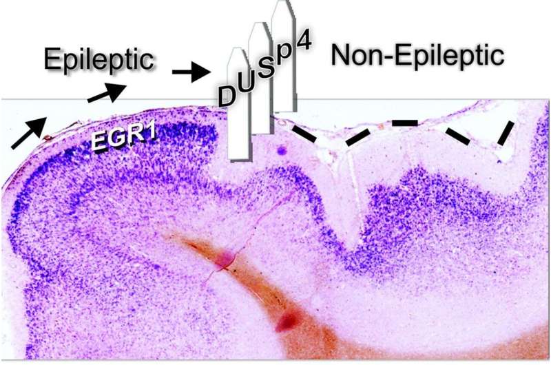 Inhibiting epileptic activity in the brain