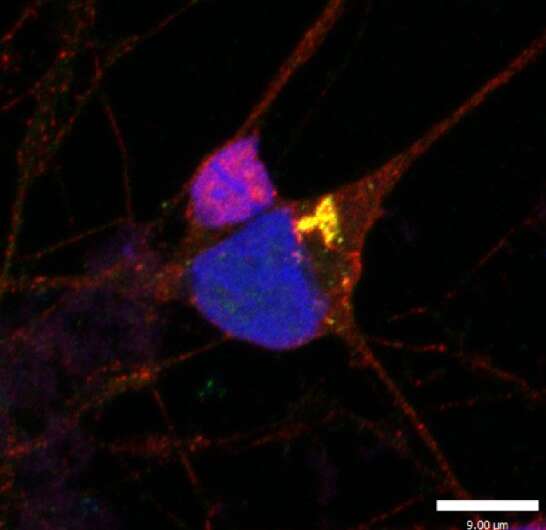 Initial protective role of nervous system's 'star-shaped cells' in sporadic motor neuron disease uncovered