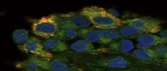 Joint cell discovery offers new hope for people with rheumatoid arthritis