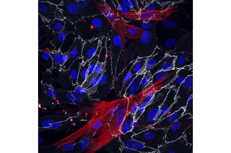 Method to derive blood vessel cells from skin cells suggests ways to slow aging