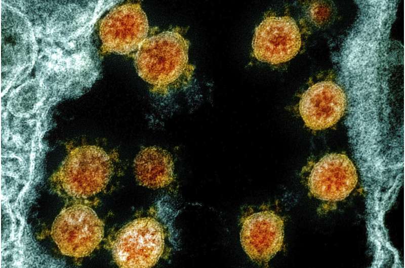 Mild to severe: Immune system holds clues to virus reaction