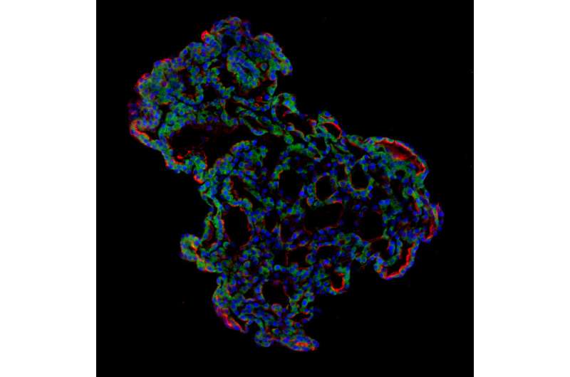 'Mini-lungs' reveal early stages of SARS-CoV-2 infection