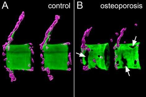 Modulating bone cell recruitment to prevent osteoporosis