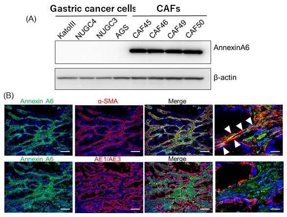 Molecule secreted by cancer-associated fibroblasts promotes anticancer drug resistance