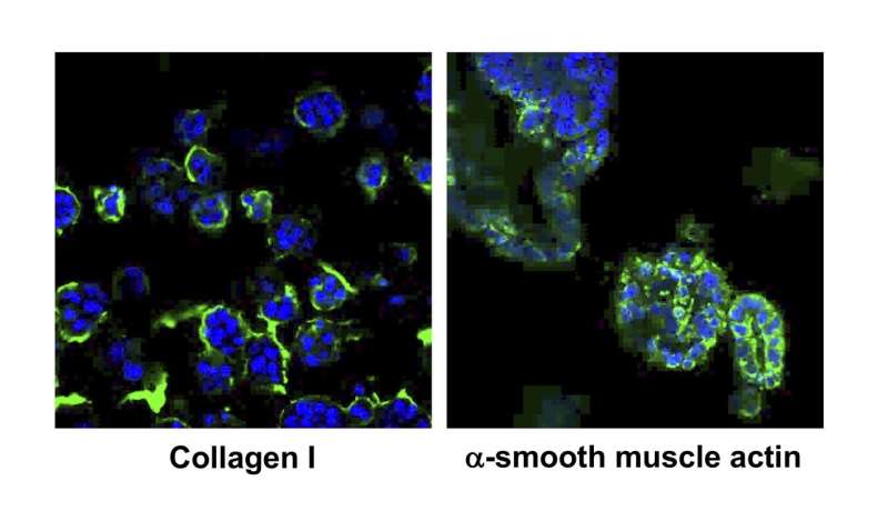 New 3D cultured cells mimic the progress of NASH