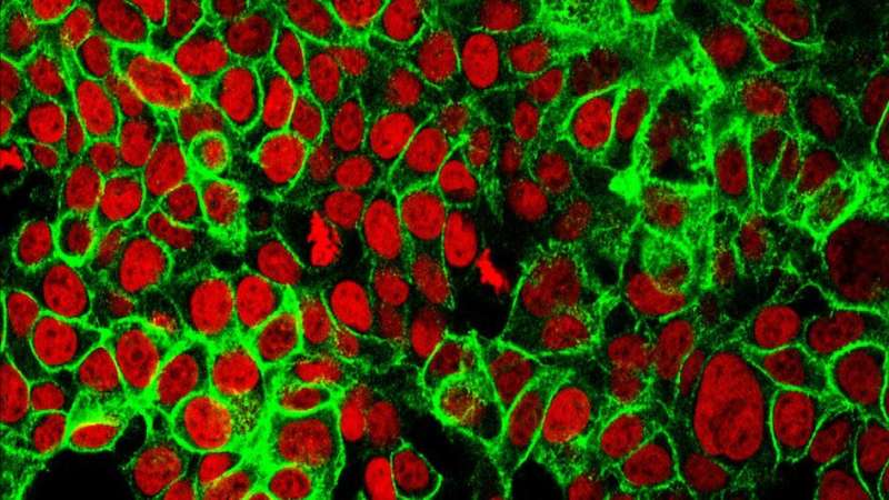 新的肠癌模型揭示如何避免免疫治疗药物