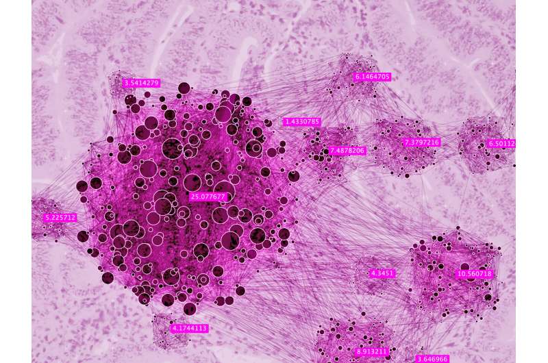新的，详细的分子路线图提高了对抗子宫内膜癌的斗争