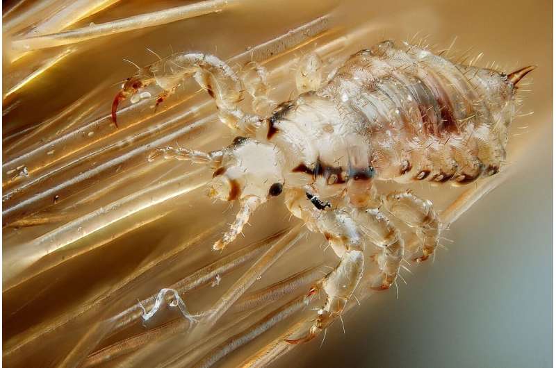 New head lice treatment approved for use in USA