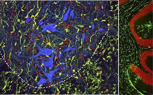 New injection technique may boost spinal cord injury repair efforts