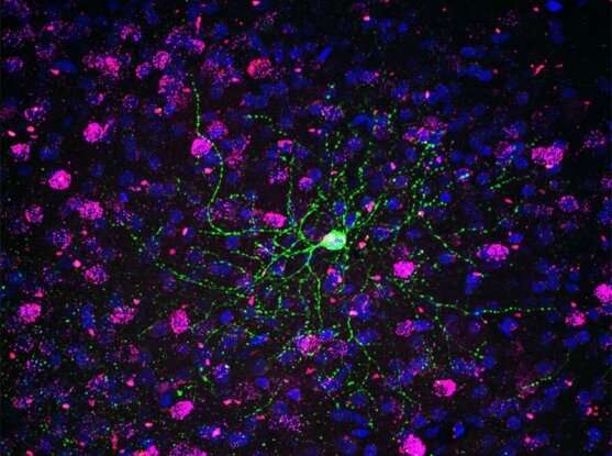 New neuron type discovered only in primate brains
