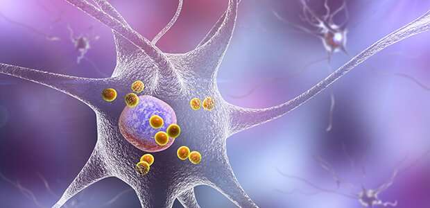 New research gives further evidence that autoimmunity plays a role in Parkinson's disease