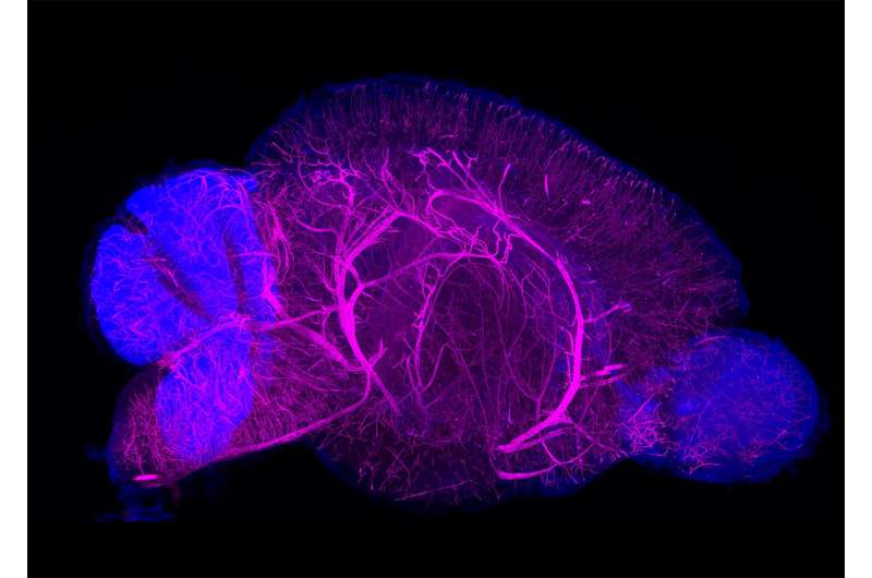 New staining technique visualizes whole organs and bodies
