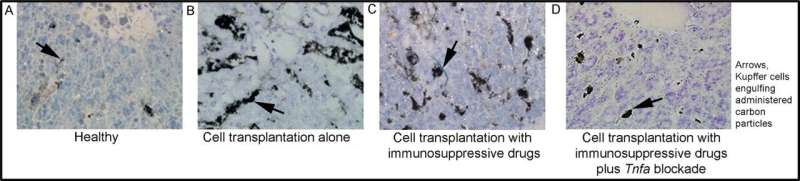 New study: available drugs can prevent rejection and tissue injury after transplantation