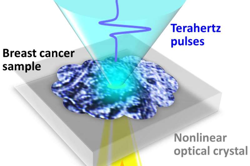 No stain? No sweat: Terahertz waves can image early-stage breast cancer without staining