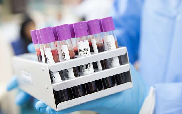 Novel coronavirus serological blood testing to identify past exposure