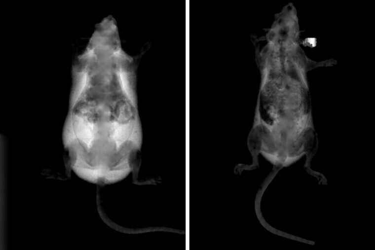 Obesity prevented in mice treated with gene-disabling nanoparticles