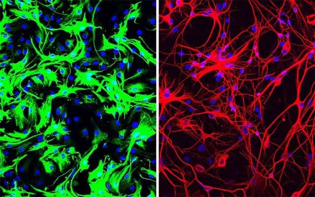One-time treatment generates new neurons, eliminates Parkinson's disease in mice