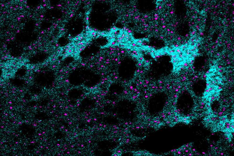 Opioid receptor MOR1 changes discovered in neurodegenerative disease model