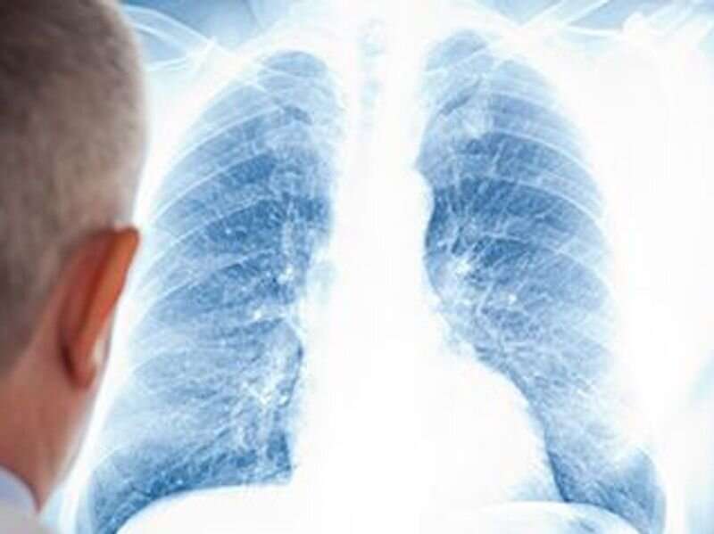 Pandemic closures, fears keep patients from lung cancer screening