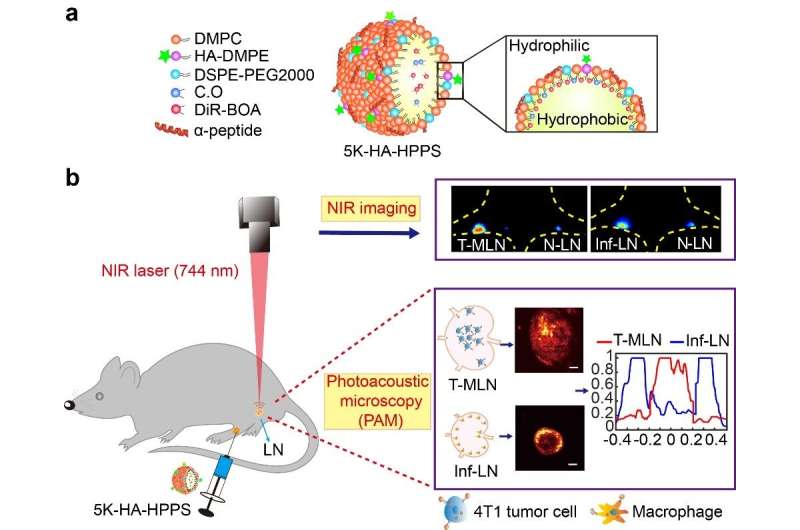 Photoacoustic microscopy for identifying sentinel lymph nodes of breast cancer