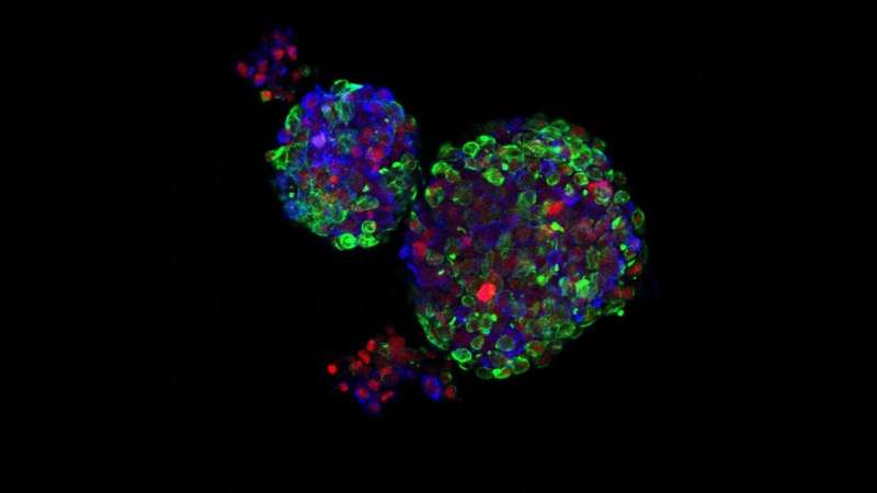 Pregnancy reprograms breast cells, reducing cancer risk