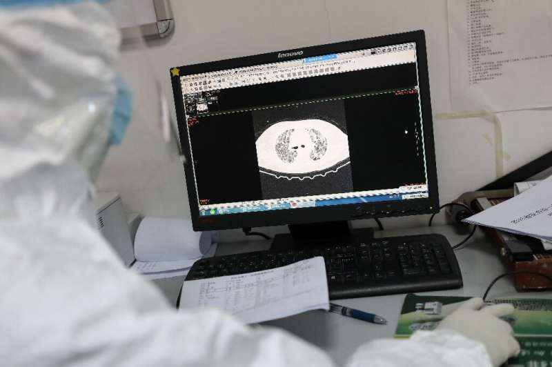 Previous diagnosis of the coronavirus in China has relied on lung imaging