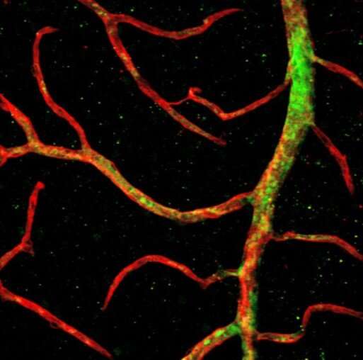 'Primitive' stem cells shown to regenerate blood vessels in the eye