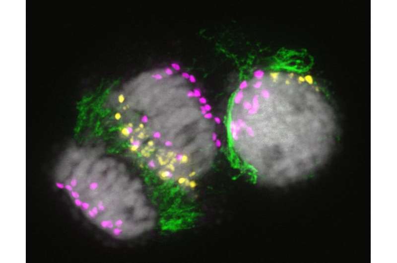 Process behind the organ-specific elimination of chromosomes in plants unveiled