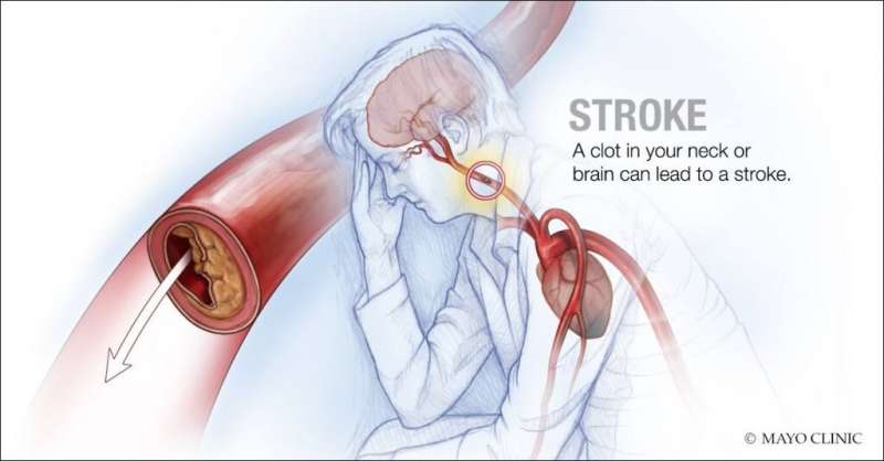 Protein in blood may predict prognosis, recovery from stroke