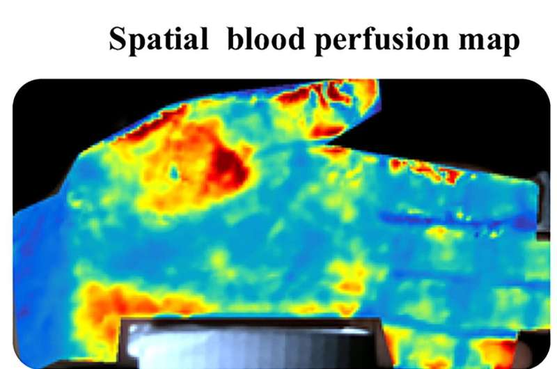 PulseCam peeks below skin to map blood flow