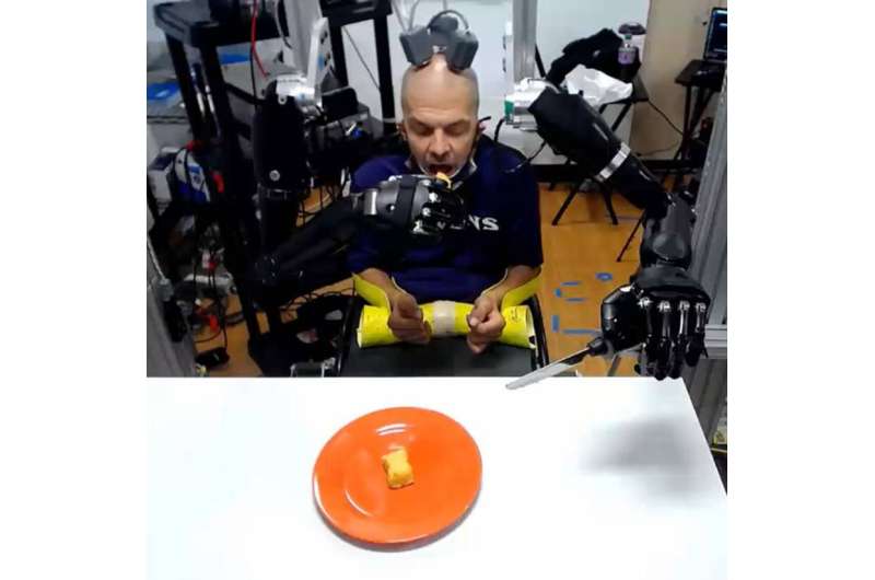Quadriplegic patient uses brain signals to feed himself with two advanced prosthetic arms
