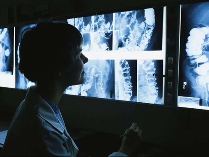 Radiologist workforce becoming increasingly subspecialized