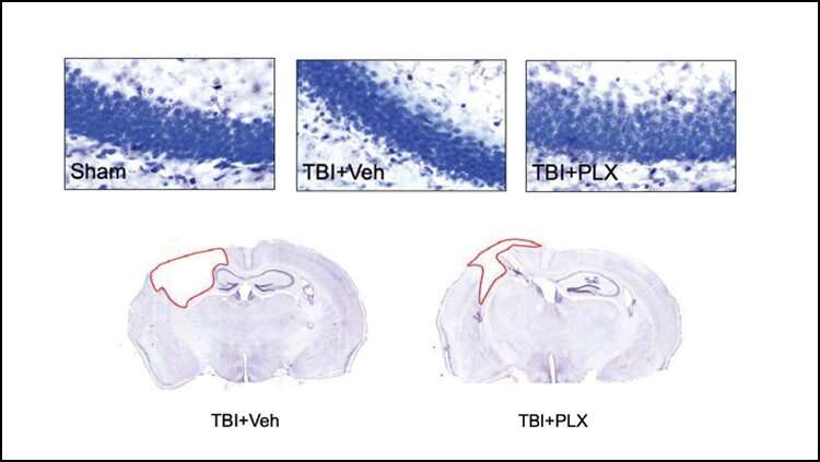 Resetting immune cells improves traumatic brain injury recovery in mice