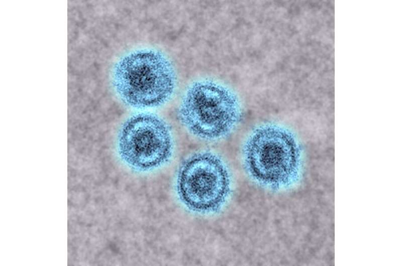 Reston virus