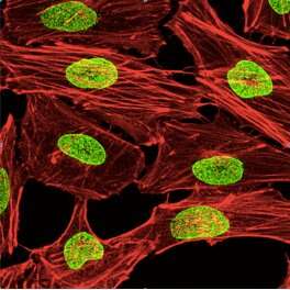 Scientists kill cancer cells by 'shutting the door' to the nucleus