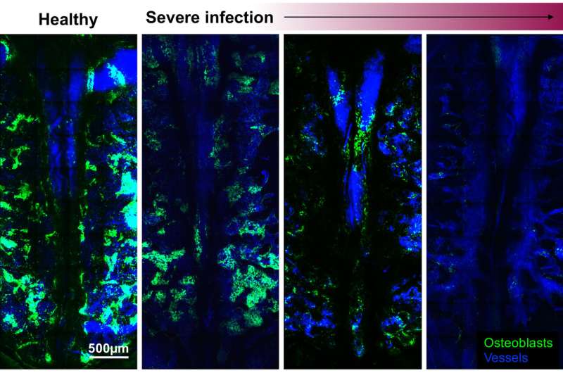 Severe infections wreak havoc on mouse blood cell production