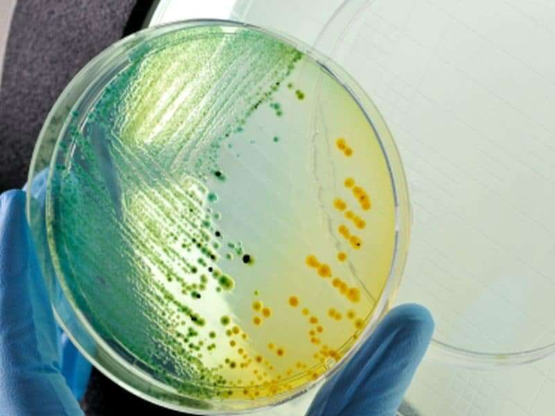Some multidrug-resistant bacterial infections down in U.S.