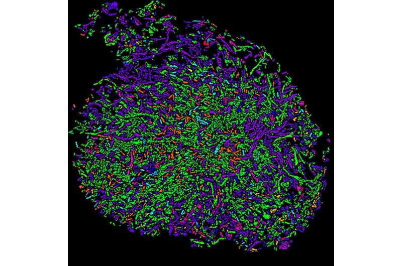 Spatial maps give new view of gut microbiome