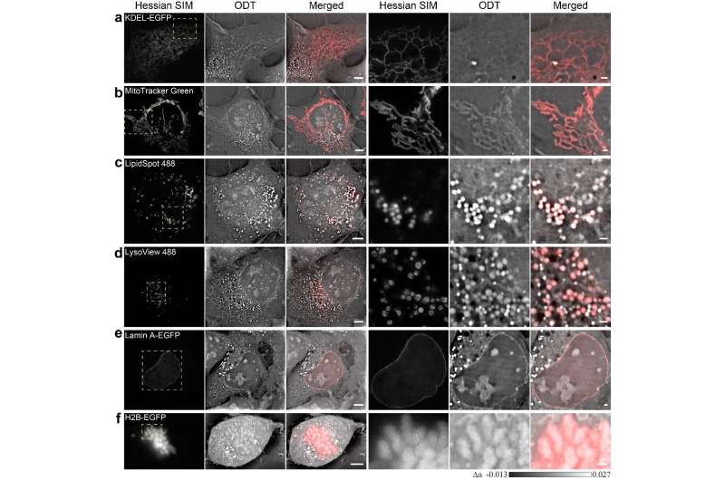 SR-FACT microscopy reveals the landscape of the cellular organelle interactome
