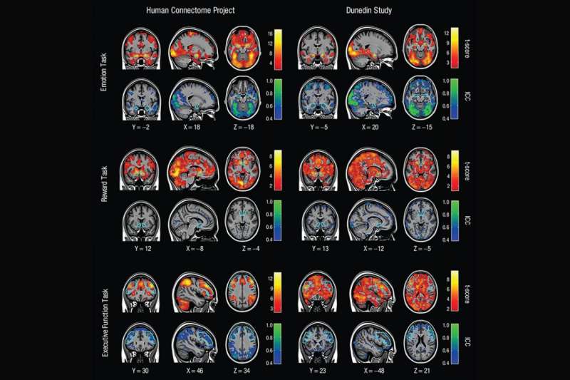 Studies of brain activity aren’t as useful as scientists thought