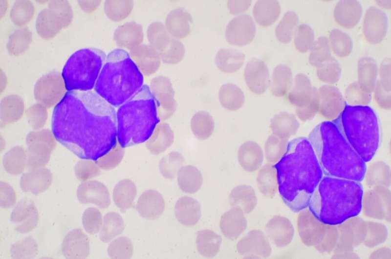 Study paves way for faster, more accurate therapies for hard-to-treat leukaemia patients